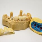 Photo Dentist Crown