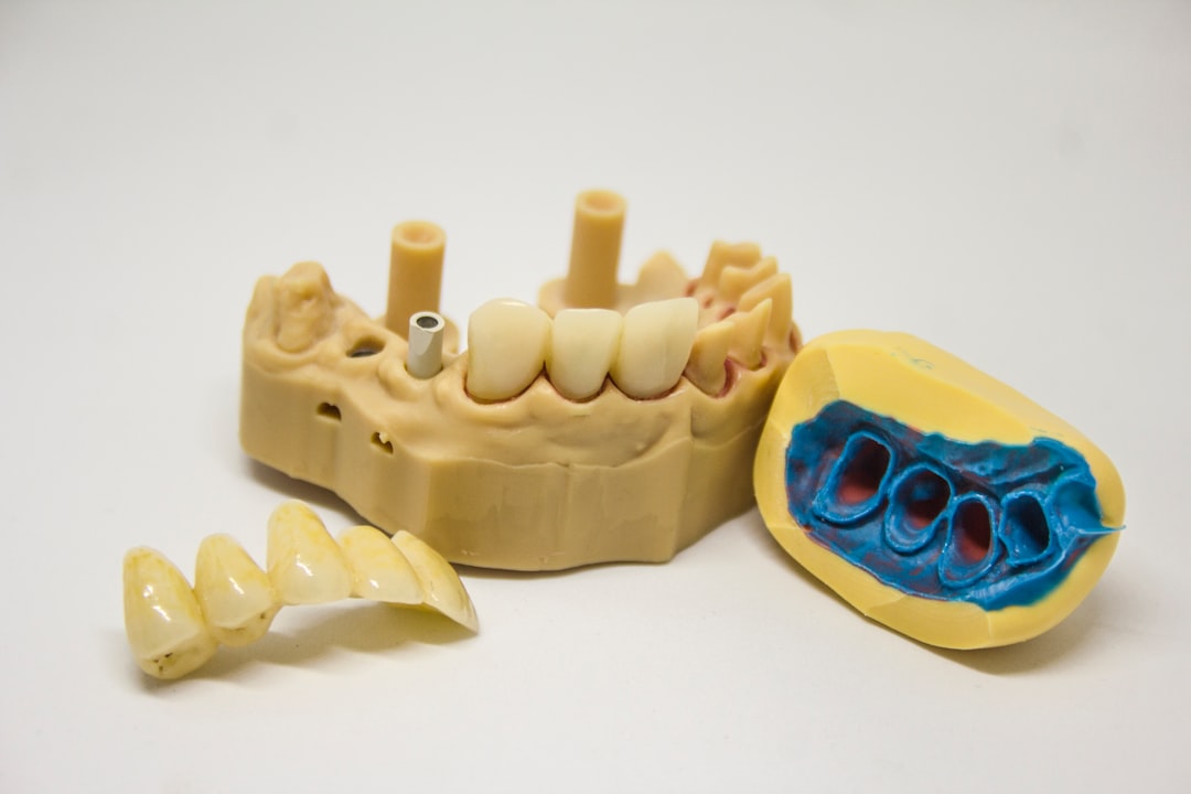 Photo Tooth implant